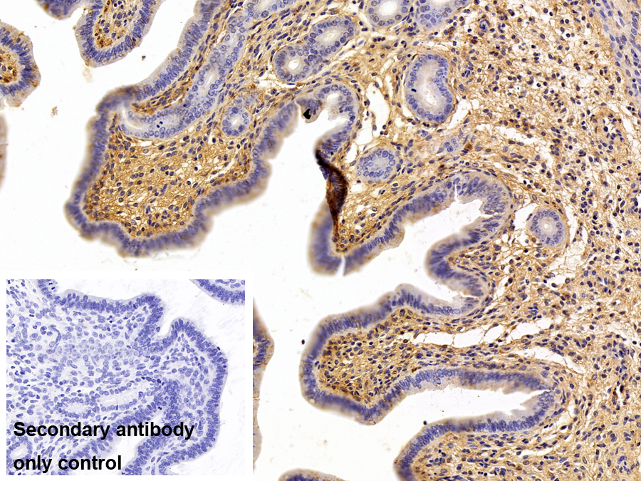 Polyclonal Antibody to Alpha-1-Antitrypsin (a1AT)