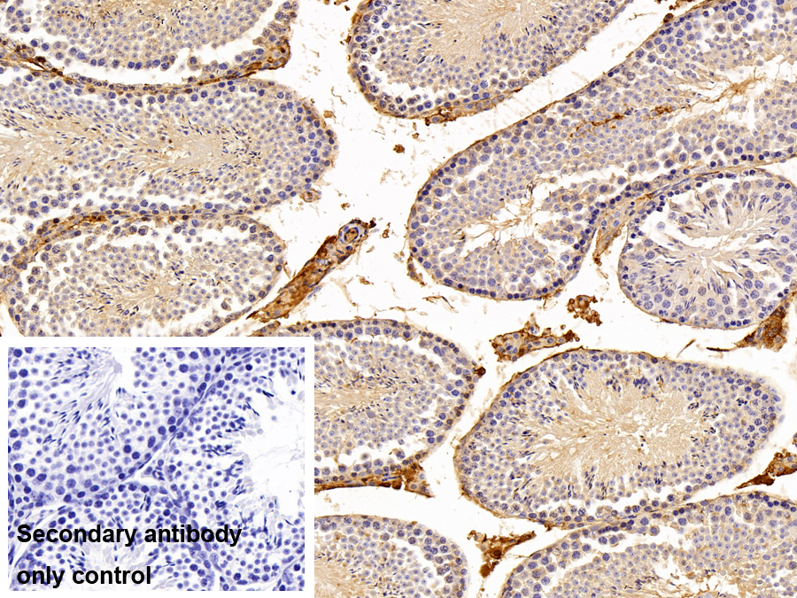 Polyclonal Antibody to Alpha-1-Antitrypsin (a1AT)