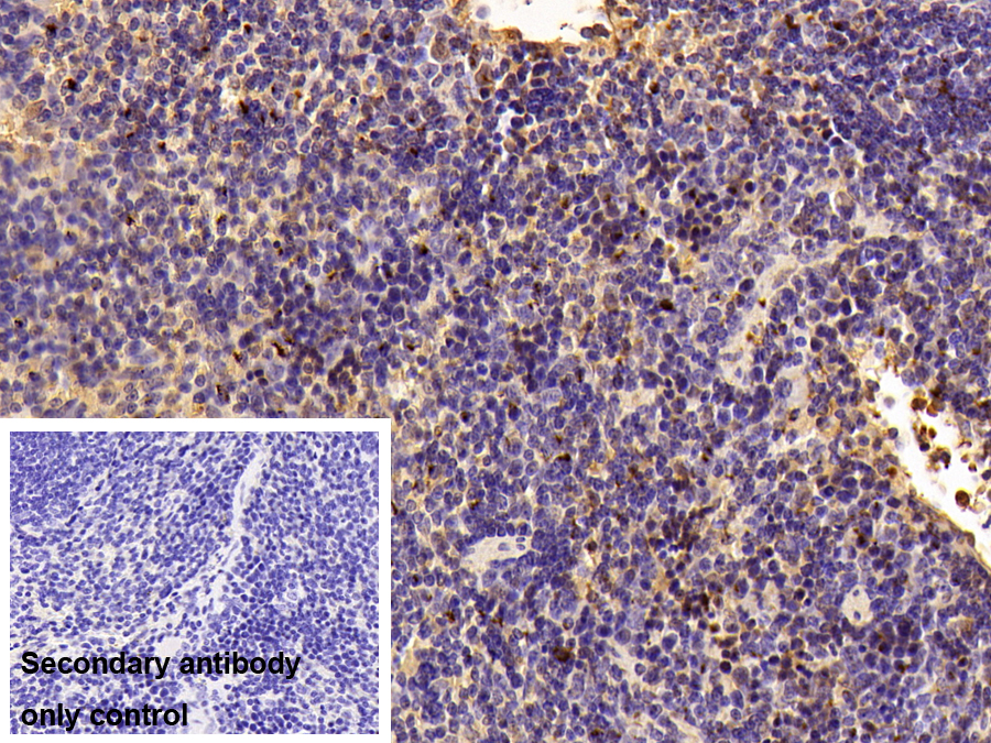 Polyclonal Antibody to Alpha-1-Antitrypsin (a1AT)