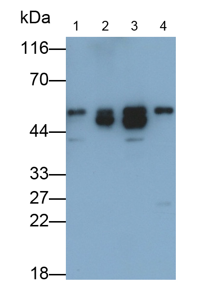 Polyclonal Antibody to Alpha-1-Antitrypsin (a1AT)