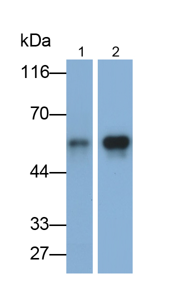 Polyclonal Antibody to Alpha-1-Antitrypsin (a1AT)