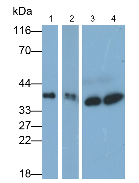 Polyclonal Antibody to Lactate Dehydrogenase B (LDHB)