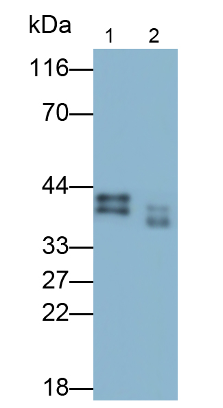 Polyclonal Antibody to Lactate Dehydrogenase B (LDHB)