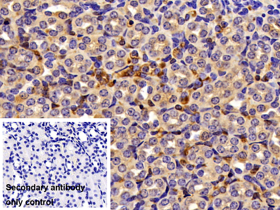 Polyclonal Antibody to Angiopoietin Like Protein 3 (ANGPTL3)