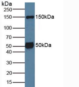 Polyclonal Antibody to Serum/Glucocorticoid Regulated Kinase 1 (SGK1)