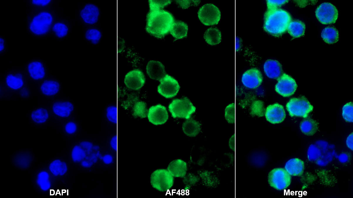 Polyclonal Antibody to B And T-Lymphocyte Attenuator (BTLA)