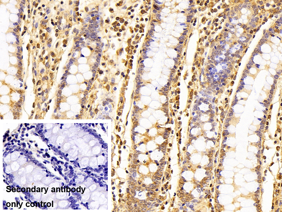 Polyclonal Antibody to Signal Transducer And Activator Of Transcription 3 (STAT3)