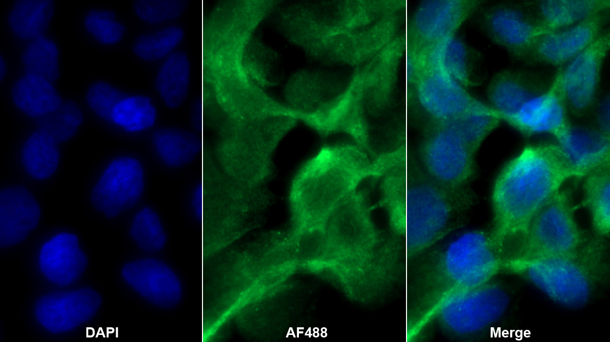 Polyclonal Antibody to Inhibin Beta B (INHbB)