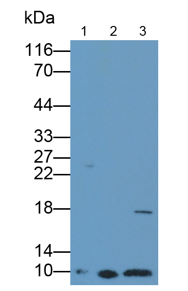 Polyclonal Antibody to S100 Calcium Binding Protein A6 (S100A6)