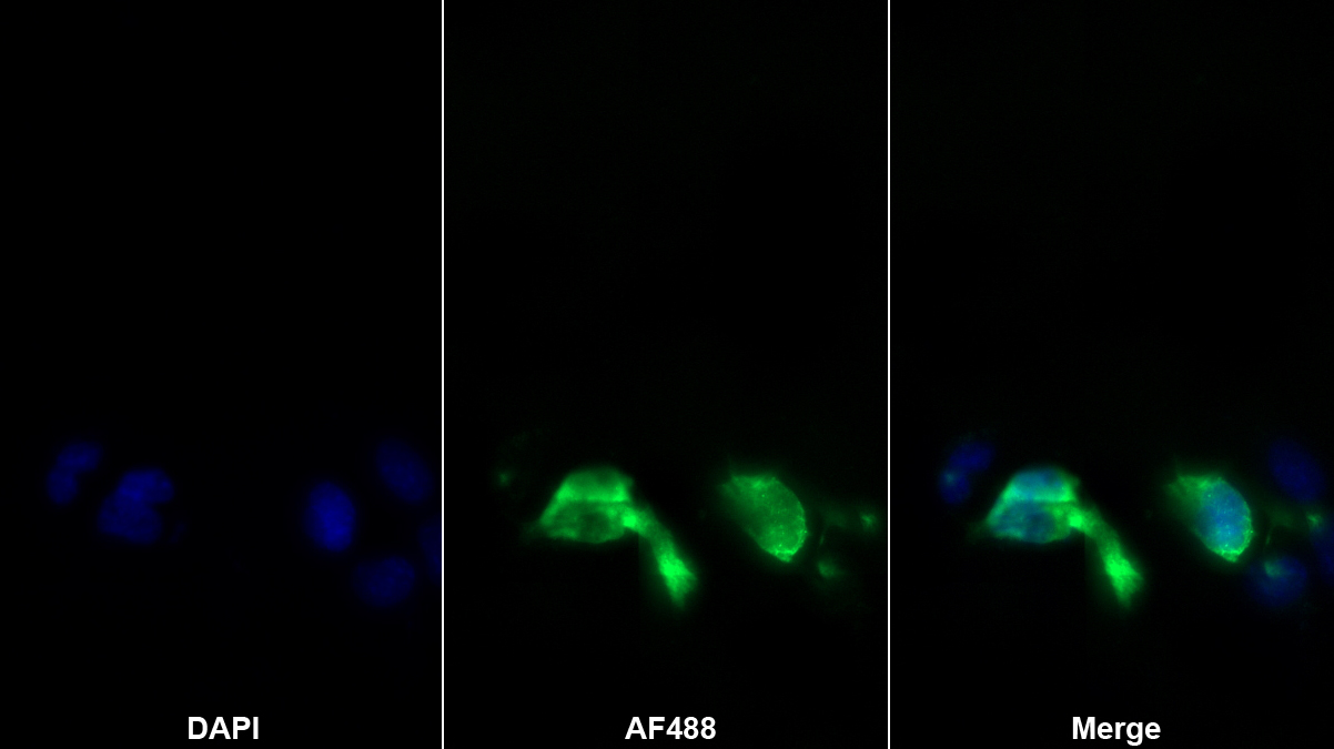 Polyclonal Antibody to S100 Calcium Binding Protein A6 (S100A6)