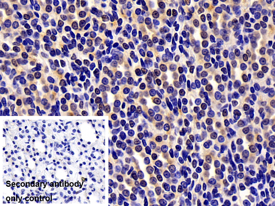 Polyclonal Antibody to S100 Calcium Binding Protein A6 (S100A6)