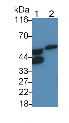 Polyclonal Antibody to Orosomucoid 2 (ORM2)