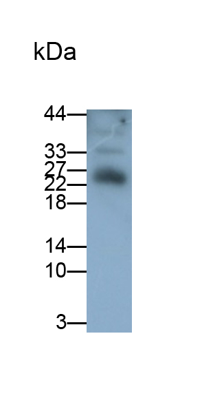 Polyclonal Antibody to Orosomucoid 2 (ORM2)