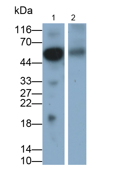 Polyclonal Antibody to Orosomucoid 2 (ORM2)