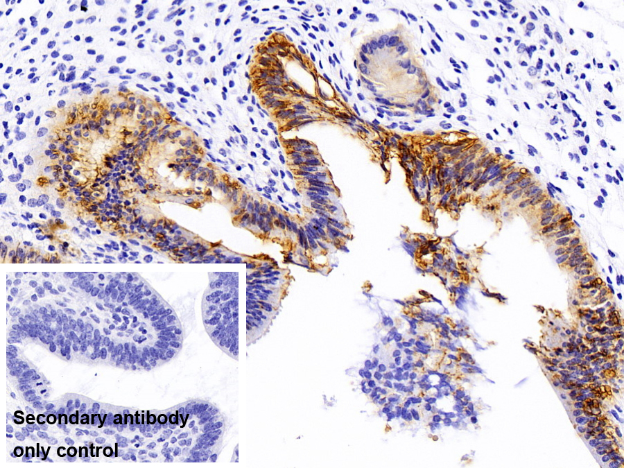 Polyclonal Antibody to Tumor Associated Calcium Signal Transducer 2 (TACSTD2)