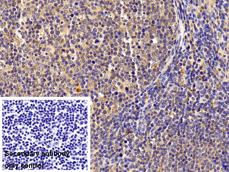 Polyclonal Antibody to S100 Calcium Binding Protein A8 (S100A8)