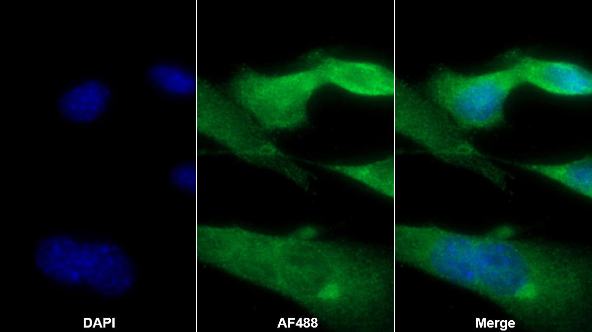 Polyclonal Antibody to S100 Calcium Binding Protein A8 (S100A8)