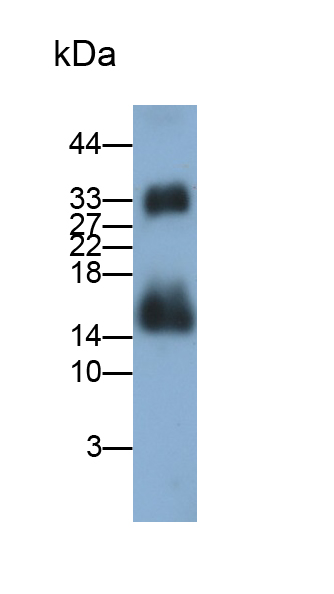 Polyclonal Antibody to S100 Calcium Binding Protein A9 (S100A9)