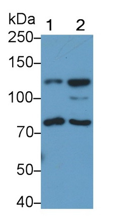 Polyclonal Antibody to Signal Transducer And Activator Of Transcription 2 (STAT2)