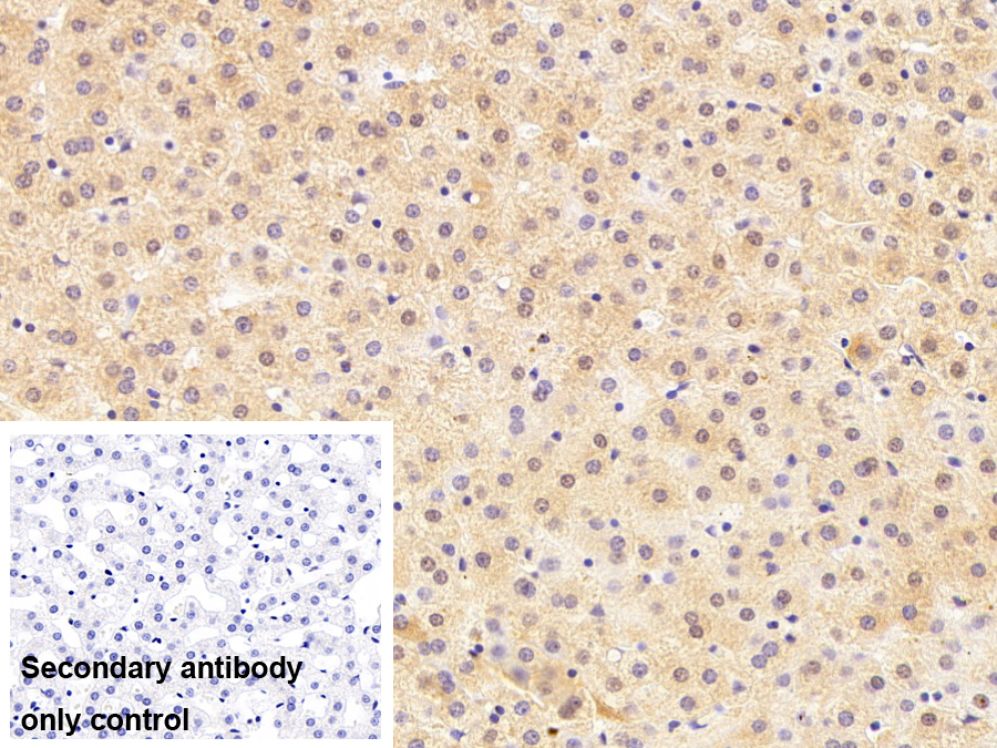 Polyclonal Antibody to Cluster Of Differentiation 5 (CD5)