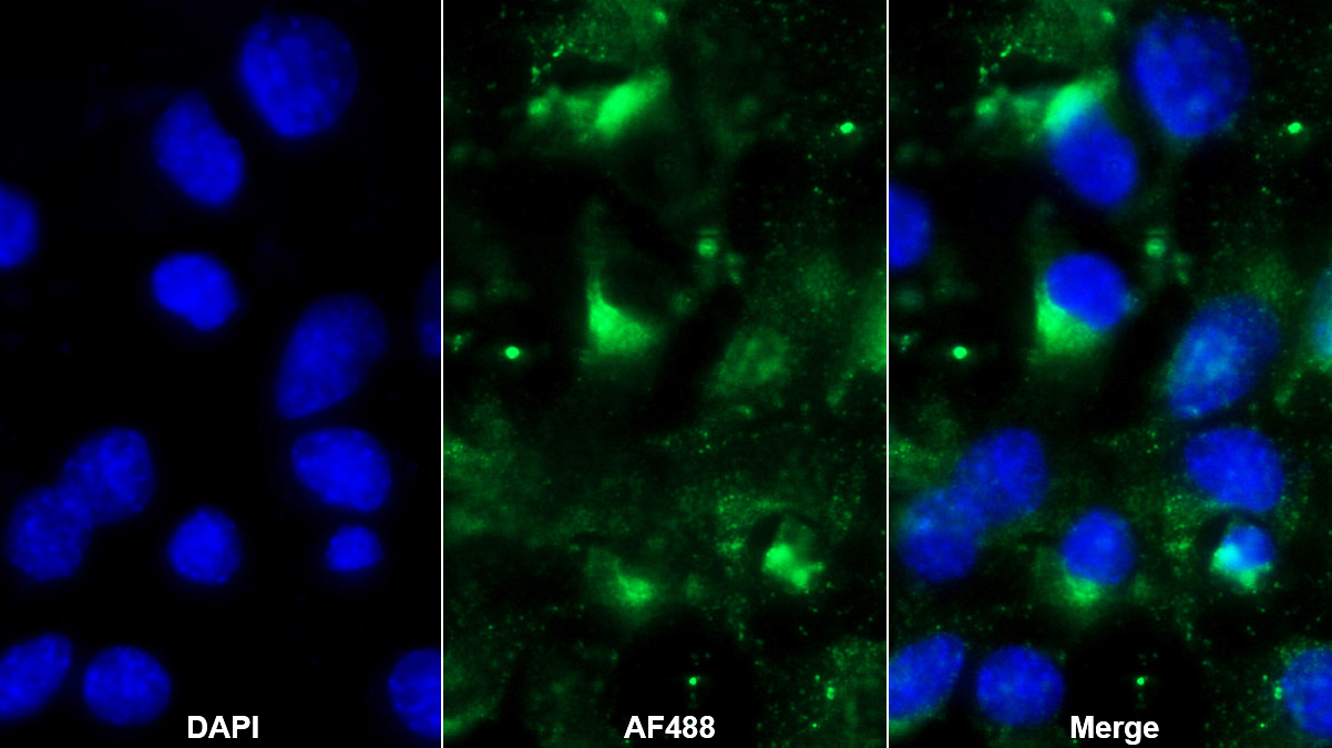 Polyclonal Antibody to Jagged 1 (JAG1)