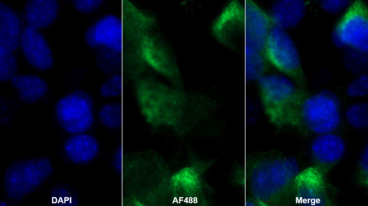 Polyclonal Antibody to Jagged 1 (JAG1)