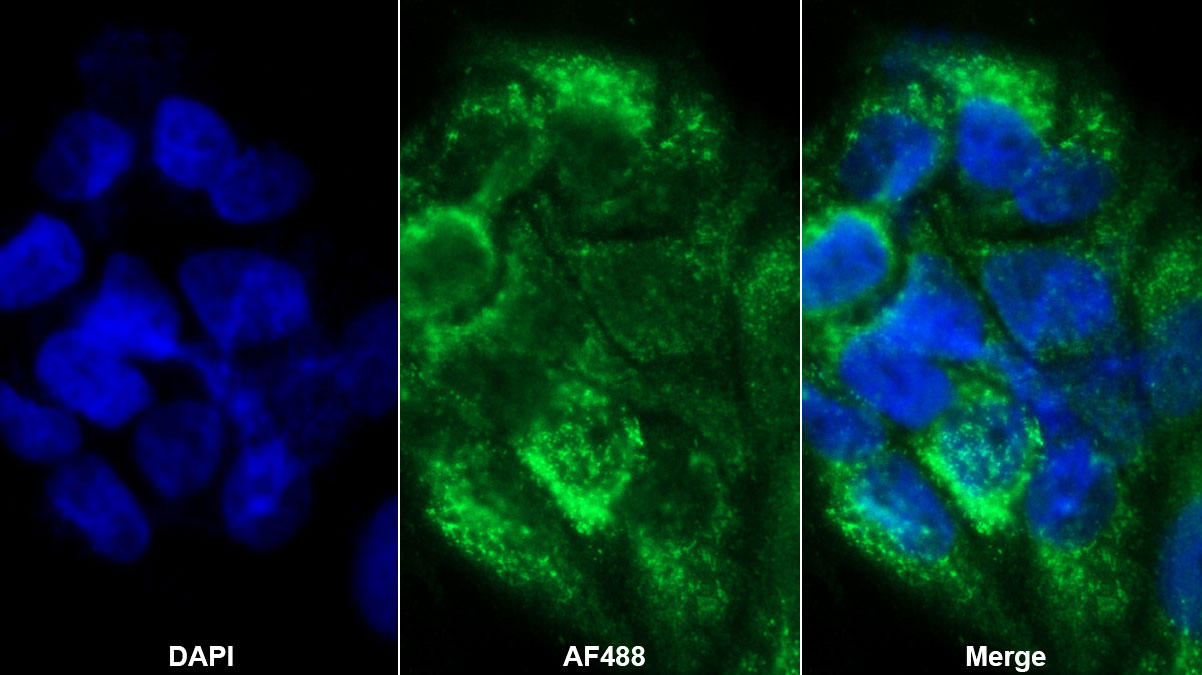 Polyclonal Antibody to Squamous Cell Carcinoma Antigen 1/2 (SCCA1/SCCA2)