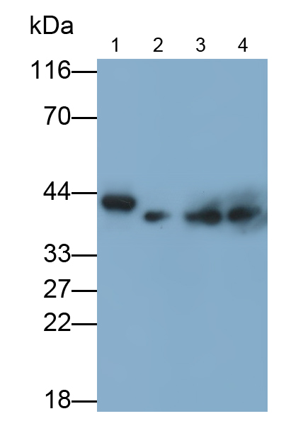 Polyclonal Antibody to Squamous Cell Carcinoma Antigen 1/2 (SCCA1/SCCA2)