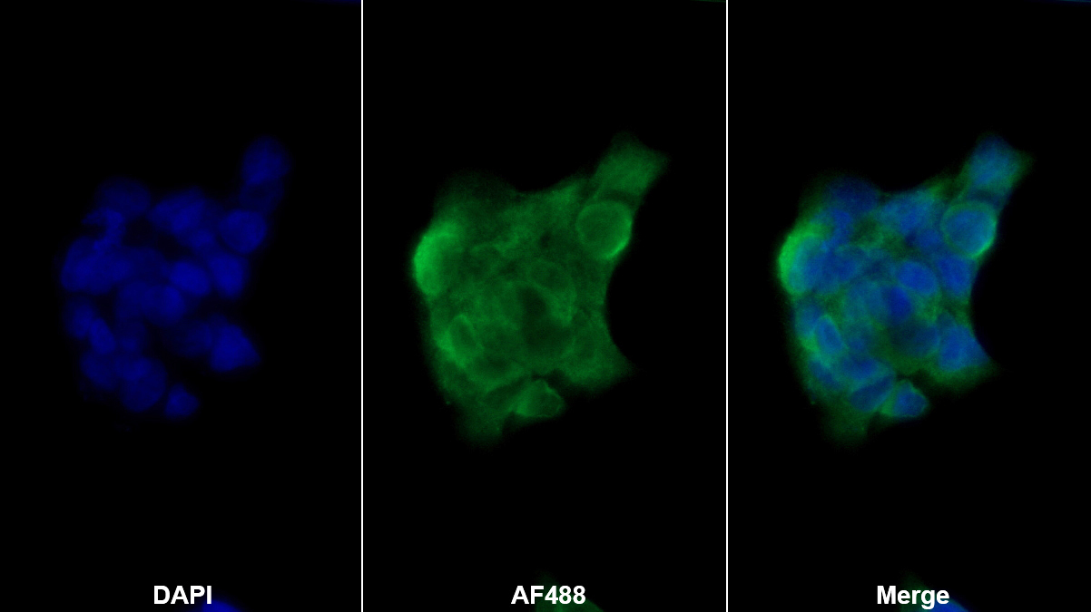 Polyclonal Antibody to Squamous Cell Carcinoma Antigen 1/2 (SCCA1/SCCA2)