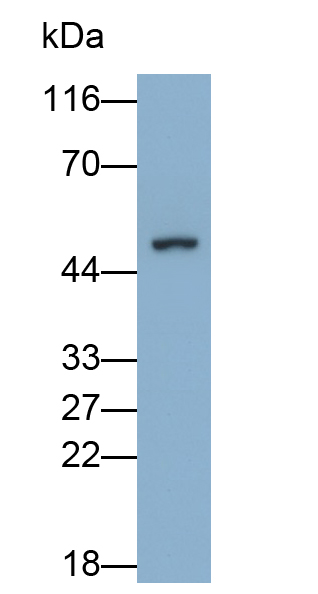 Polyclonal Antibody to Interleukin 6 Receptor (IL6R)