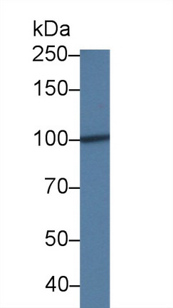 Polyclonal Antibody to Vascular Endothelial Growth Factor Receptor 1 (VEGFR1)