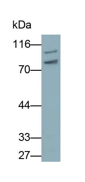 Polyclonal Antibody to Transglutaminase 2 (TGM2)