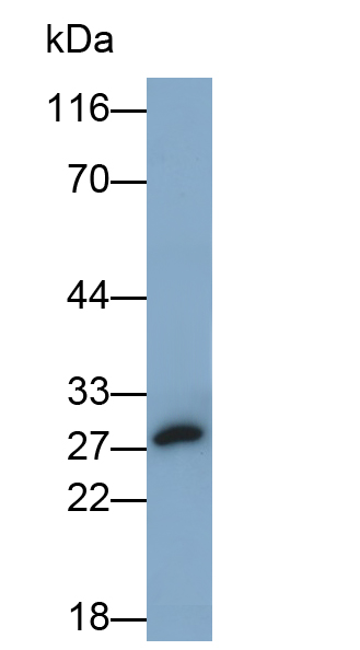 Polyclonal Antibody to Complement Factor D (CFD)