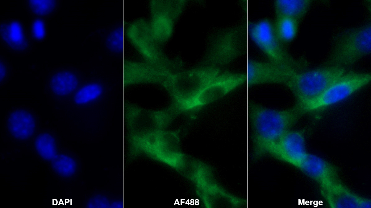 Polyclonal Antibody to Paxillin (PXN)