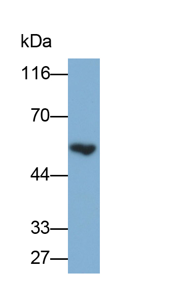 Polyclonal Antibody to Matrix Metalloproteinase 19 (MMP19)