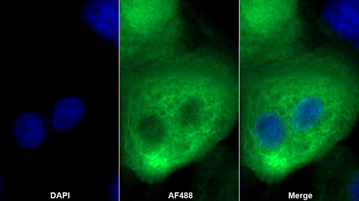 Polyclonal Antibody to Cytokeratin 13 (CK13)