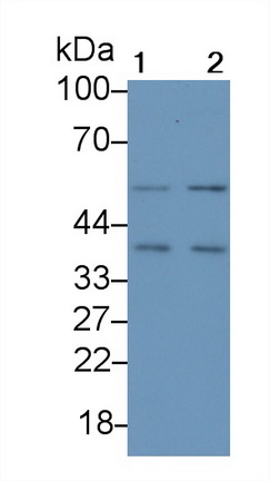 Polyclonal Antibody to Cyclin Dependent Kinase 7 (CDK7)