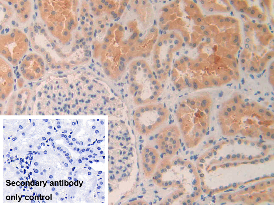 Polyclonal Antibody to Matrix Metalloproteinase 24 (MMP24)