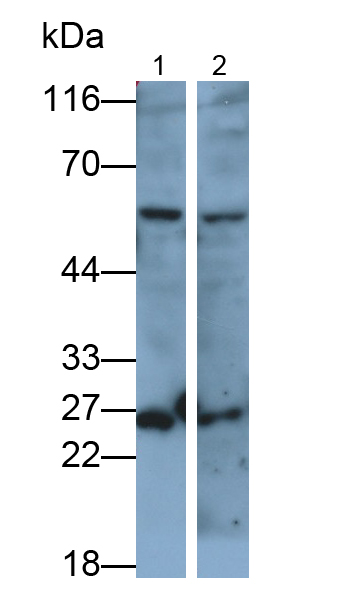 Polyclonal Antibody to Mannose Associated Serine Protease 1 (MASP1)