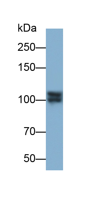 Polyclonal Antibody to Insulin Degrading Enzyme (IDE)