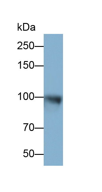 Polyclonal Antibody to Insulin Degrading Enzyme (IDE)