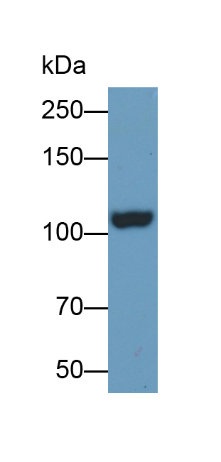Polyclonal Antibody to Insulin Degrading Enzyme (IDE)