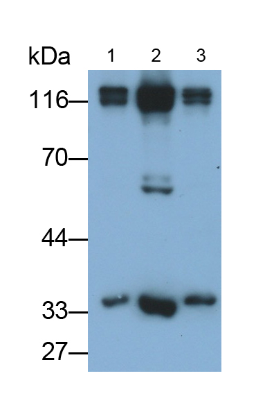 Polyclonal Antibody to Insulin Degrading Enzyme (IDE)