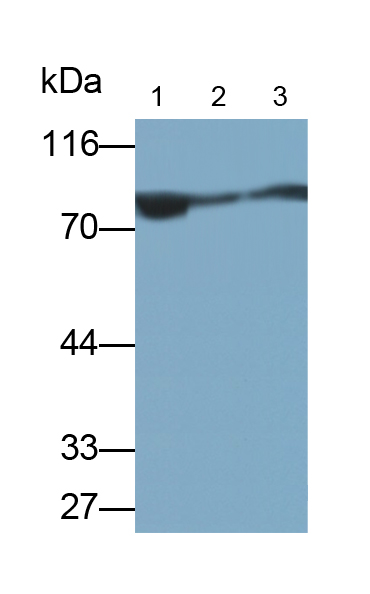 Polyclonal Antibody to Oxidosqualene Cyclase (OSC)