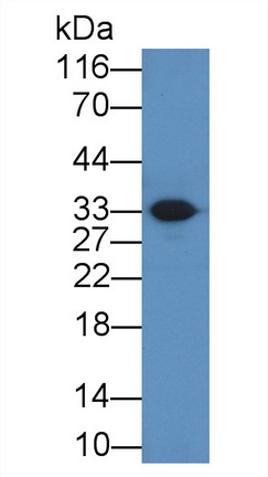 Polyclonal Antibody to Ficolin 3 (FCN3)