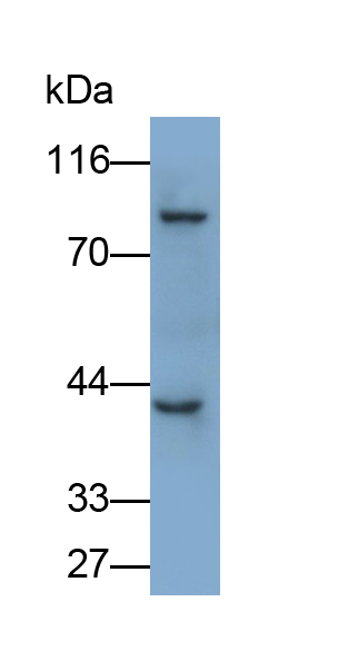 Polyclonal Antibody to Protein Kinase C Alpha (PKCa)