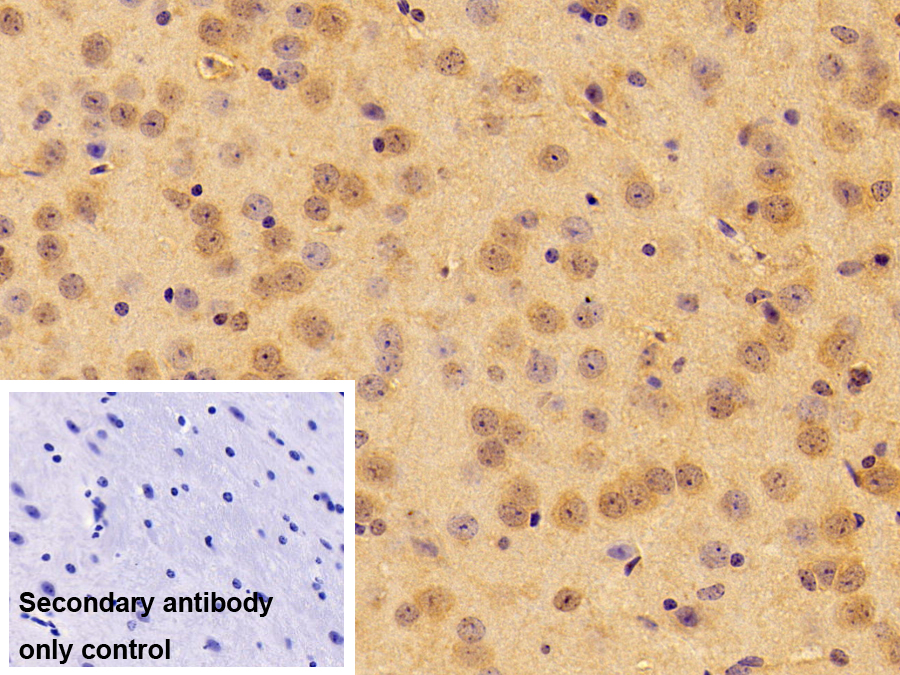 Polyclonal Antibody to Choline Acetyltransferase (ChAT)
