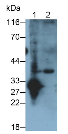 Polyclonal Antibody to Cathepsin S (CTSS)