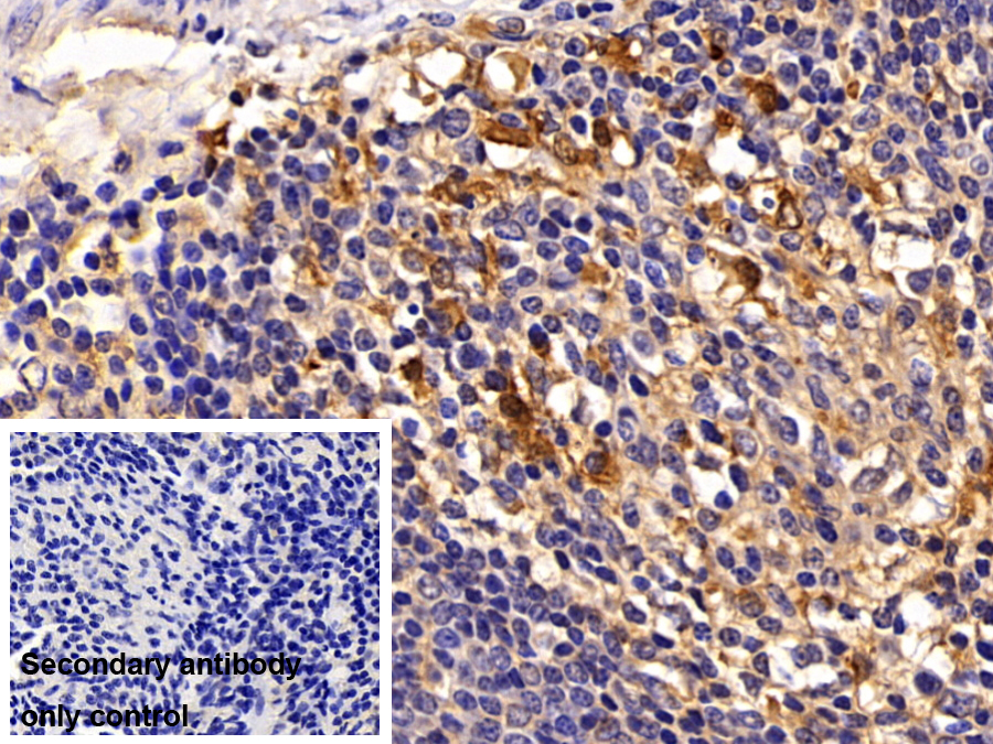 Polyclonal Antibody to Cathepsin S (CTSS)