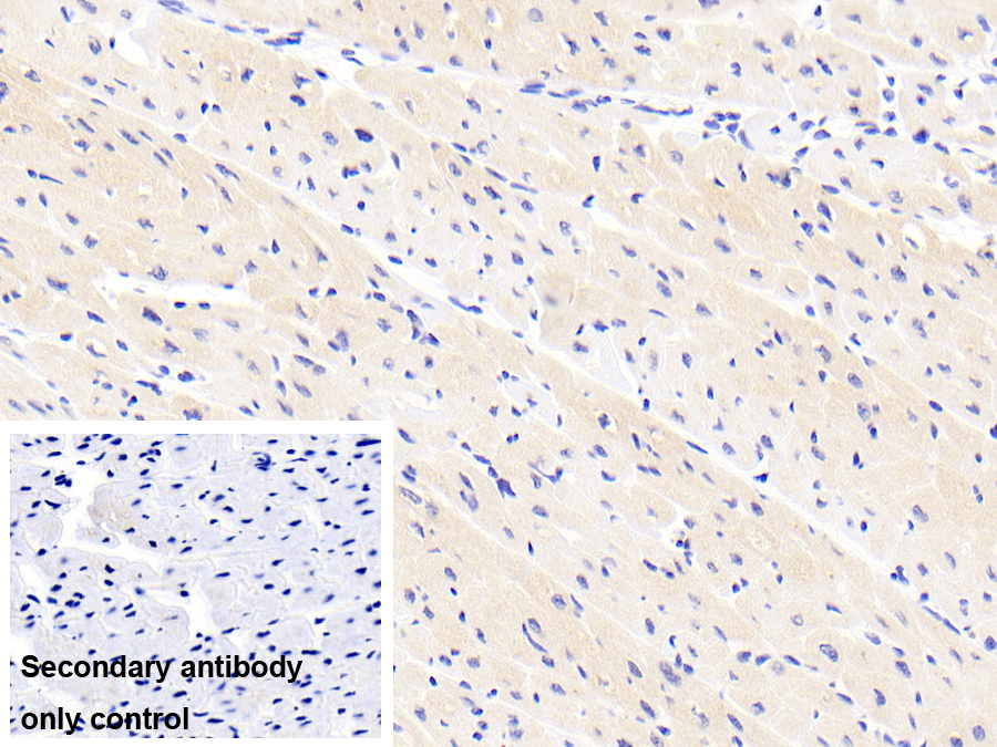 Polyclonal Antibody to Tenascin X (TNX)